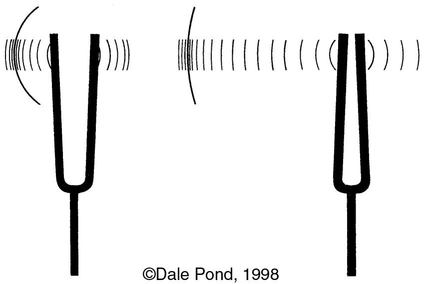 physics behind tuning fork test